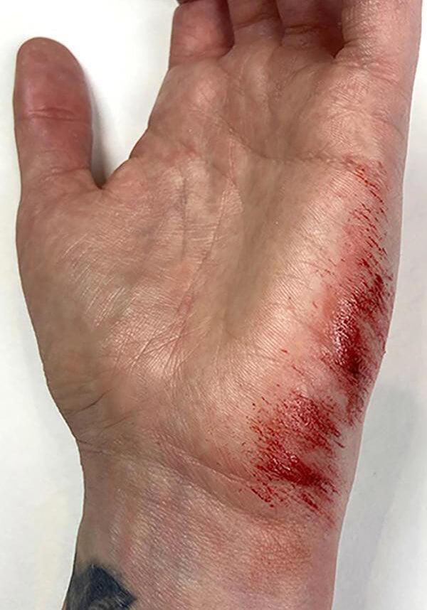 Thumb 3